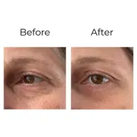 Peptilux – Anti-Falten Augencreme „Shock Action“-Effekt mit LIPHASYN™ - 20 ml