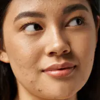 SuppleFit Nahrungsergänzungsmittel in Kapseln SKINPURE - 60 Kapseln